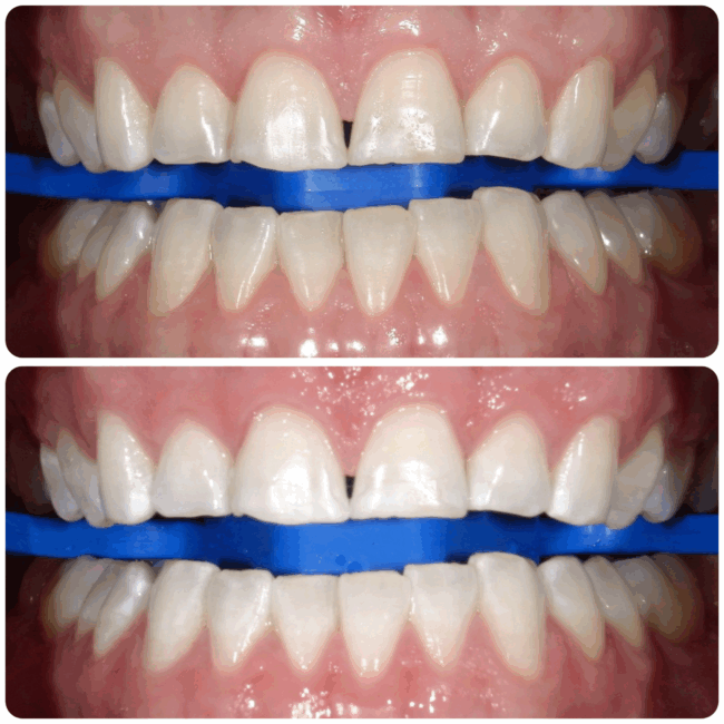 Corey Zoom Results - Copy